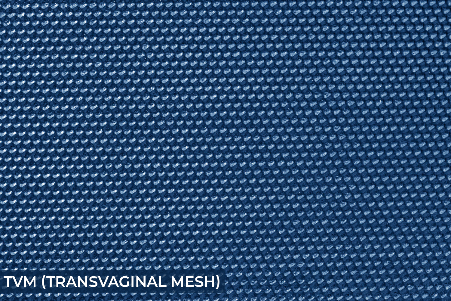 Tvm Transvaginal Mesh Neural It